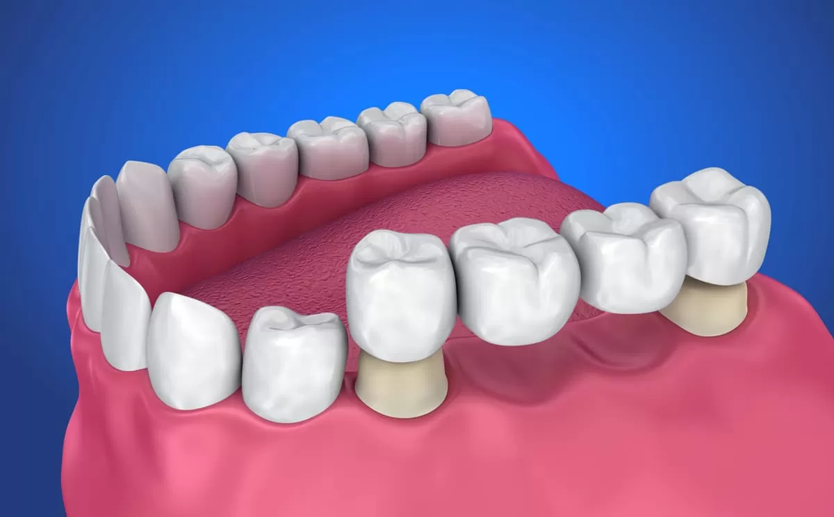 Description of image